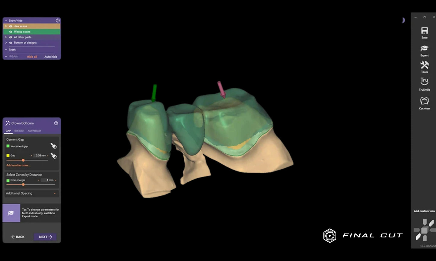 Exocad Software - FinalCut™