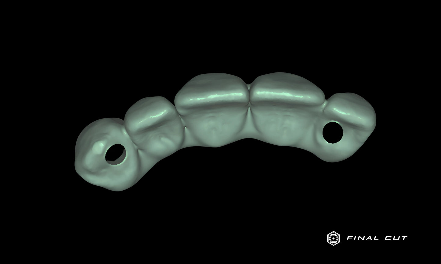 PMMA Implant Crown & Bridge - Design Service - FinalCut™