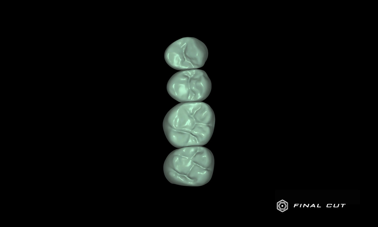 PMMA Crown & Bridge - Design Service - FinalCut™