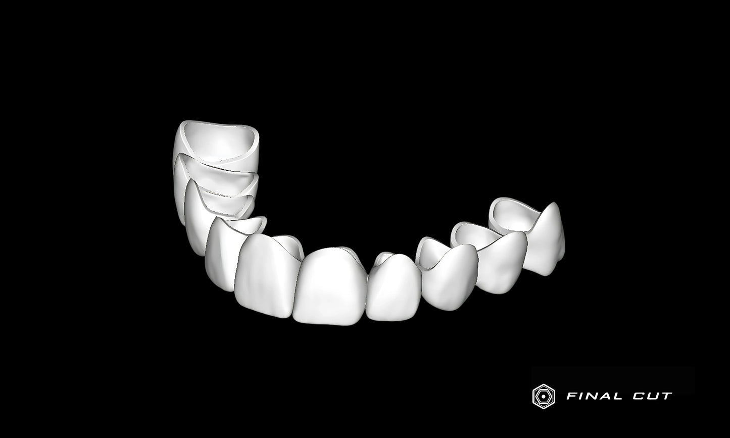 PMMA Crown & Bridge - Design Service - FinalCut™