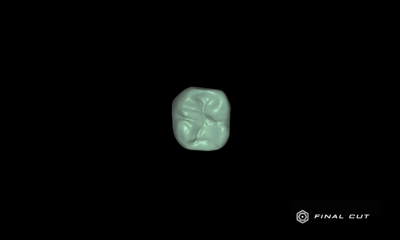 PMMA Crown & Bridge - Design Service - FinalCut™