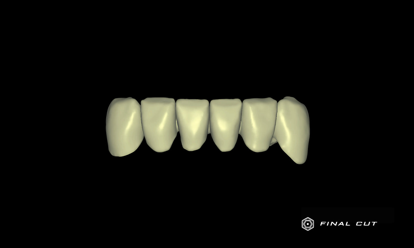 PMMA Crown & Bridge - Milling Service - FinalCut™