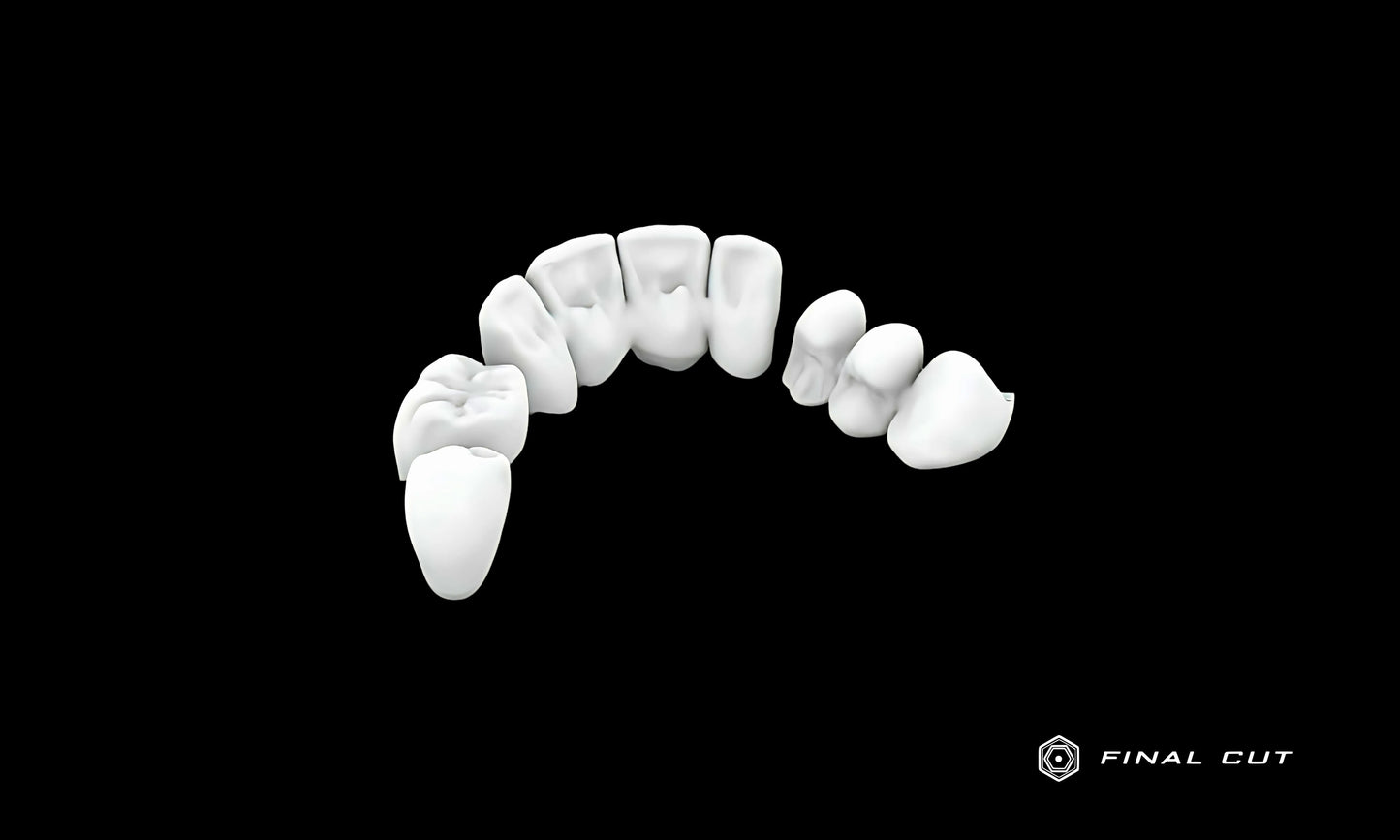PMMA Crown & Bridge - Design Service - FinalCut™