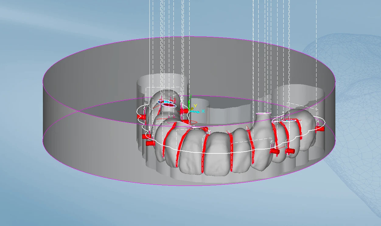 PMMA Hybrid Full Arch - Milling Service - FinalCut™