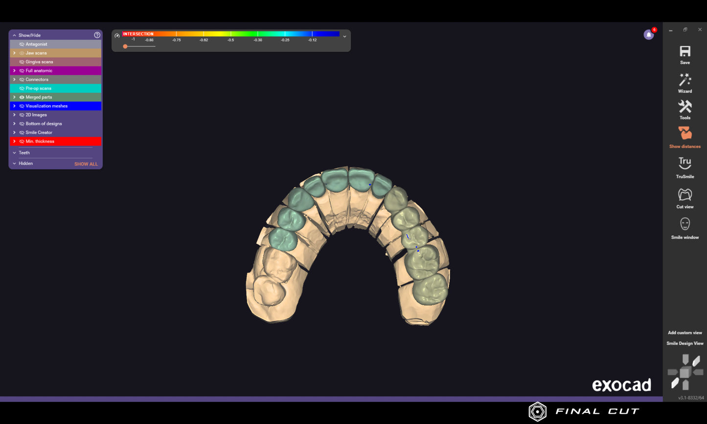 PMMA Crown & Bridge - Design & Milling Service - FinalCut™