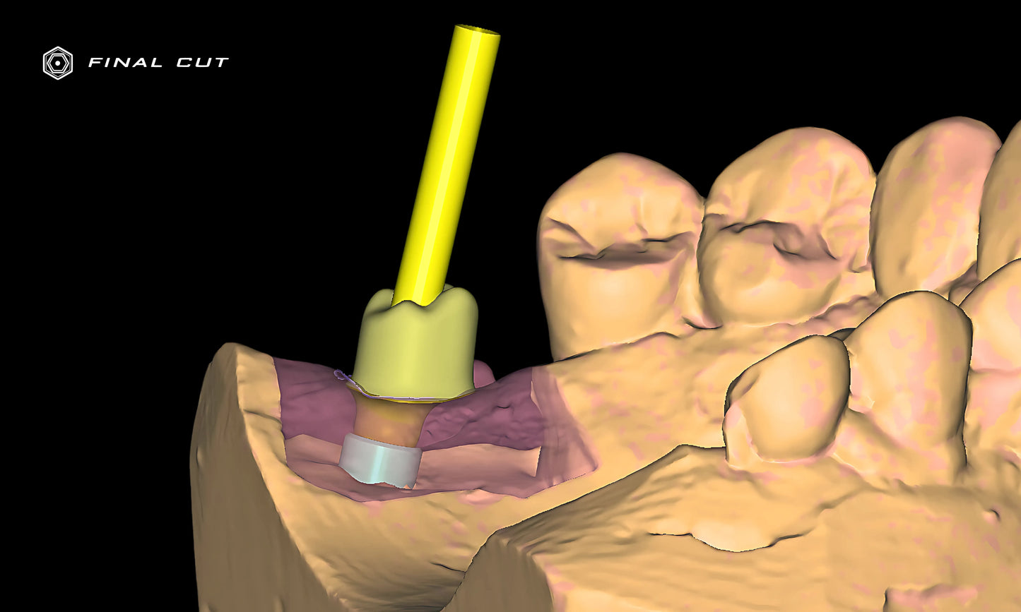 Titanium Custom Abutment - Design & Milling Service - FinalCut™