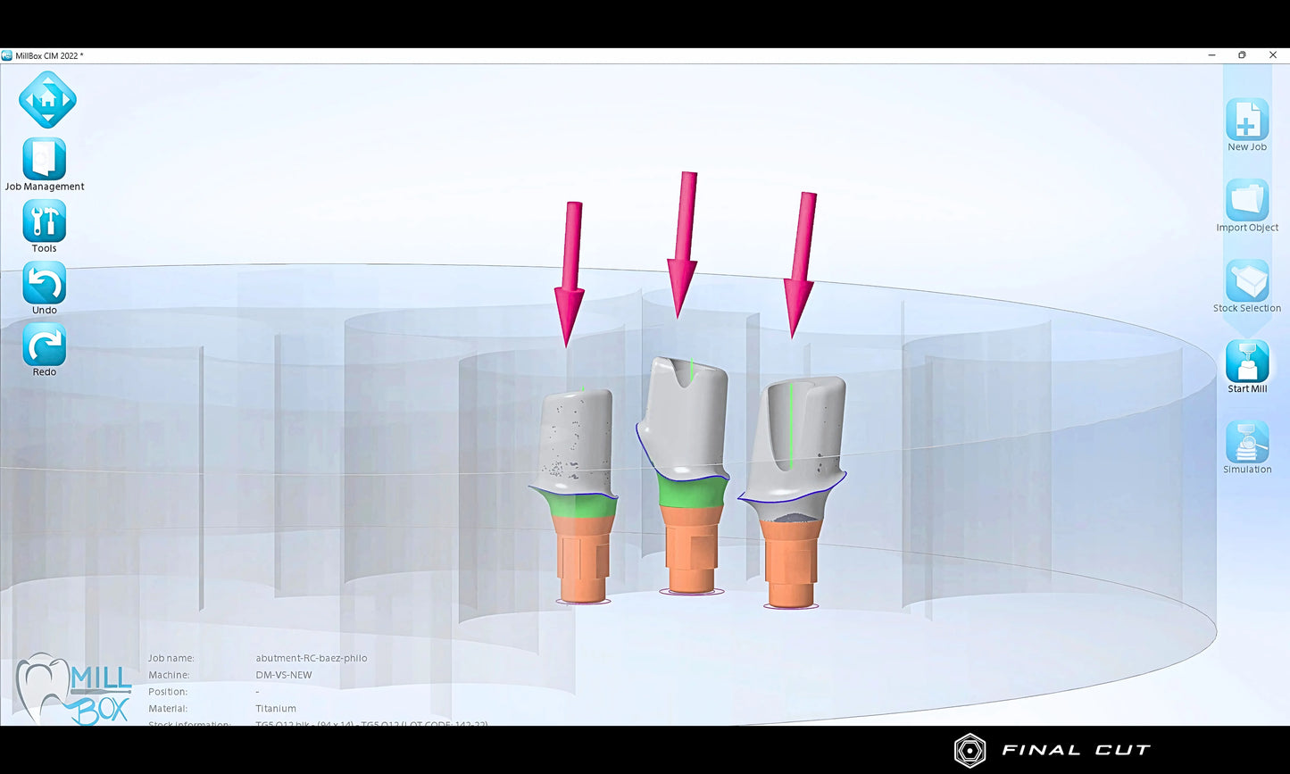 Titanium Custom Abutment - Milling Service - FinalCut™