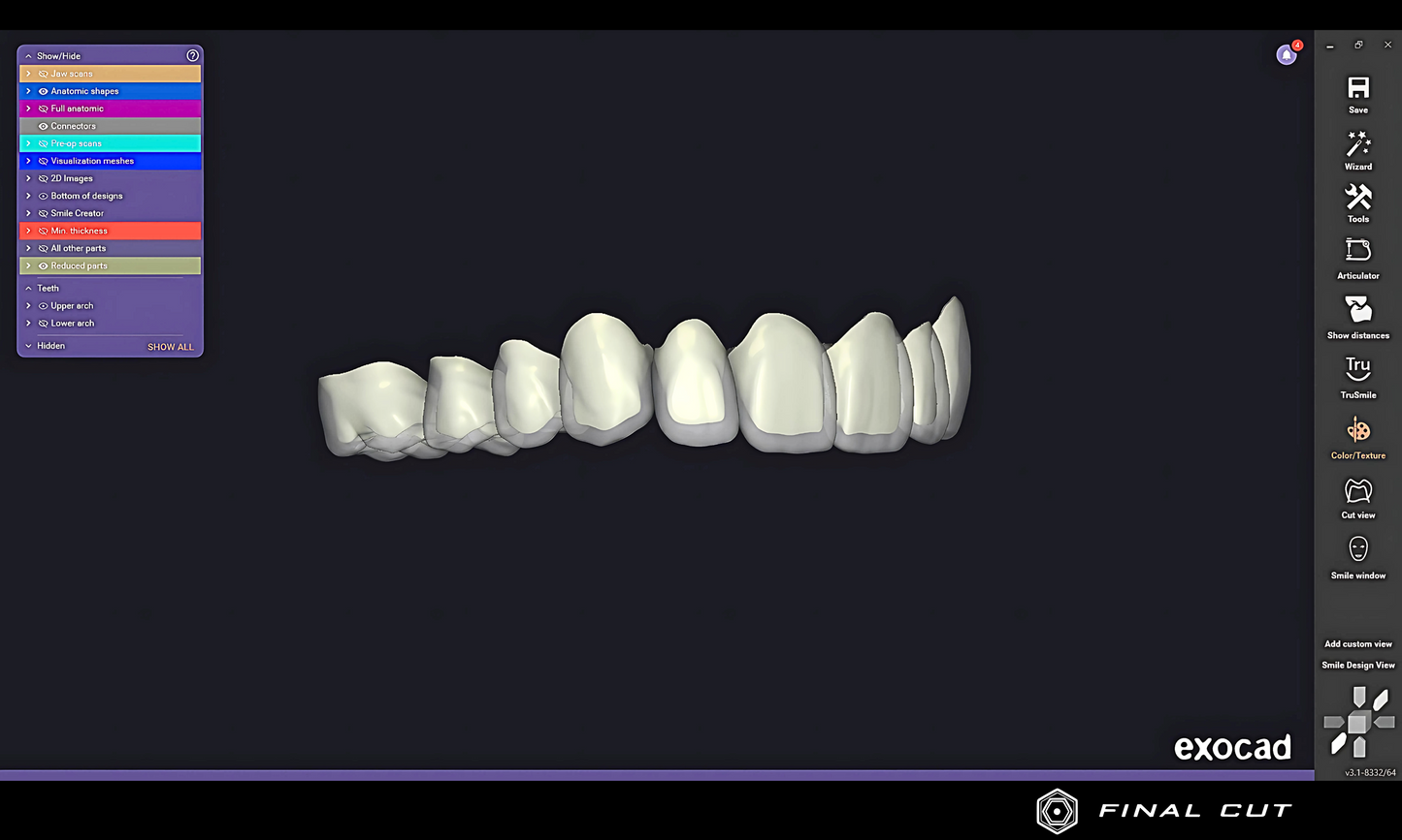 Zirconia Coping - Design & Milling Service - FinalCut™
