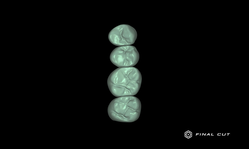 Zirconia Crown & Bridge - Design Service - FinalCut™