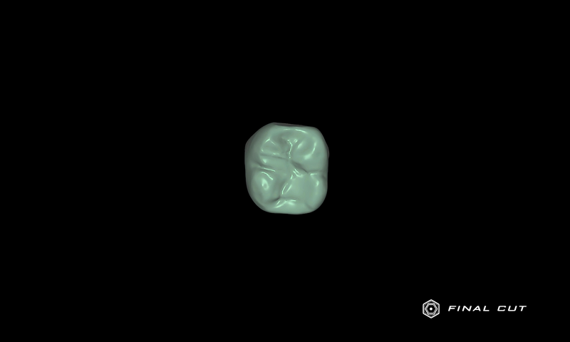 Zirconia Crown & Bridge - Design Service - FinalCut™