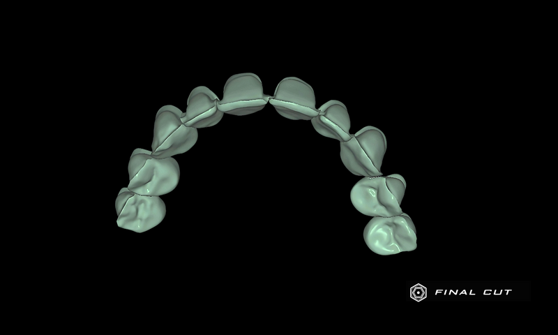Zirconia Crown & Bridge - Design Service - FinalCut™