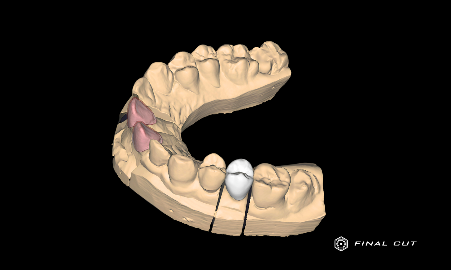 Zirconia Crown & Bridge - Design & Milling Service - FinalCut™