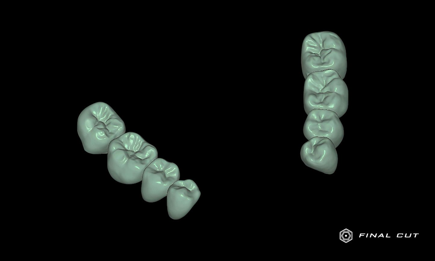 Zirconia Crown & Bridge - Design & Milling Service - FinalCut™