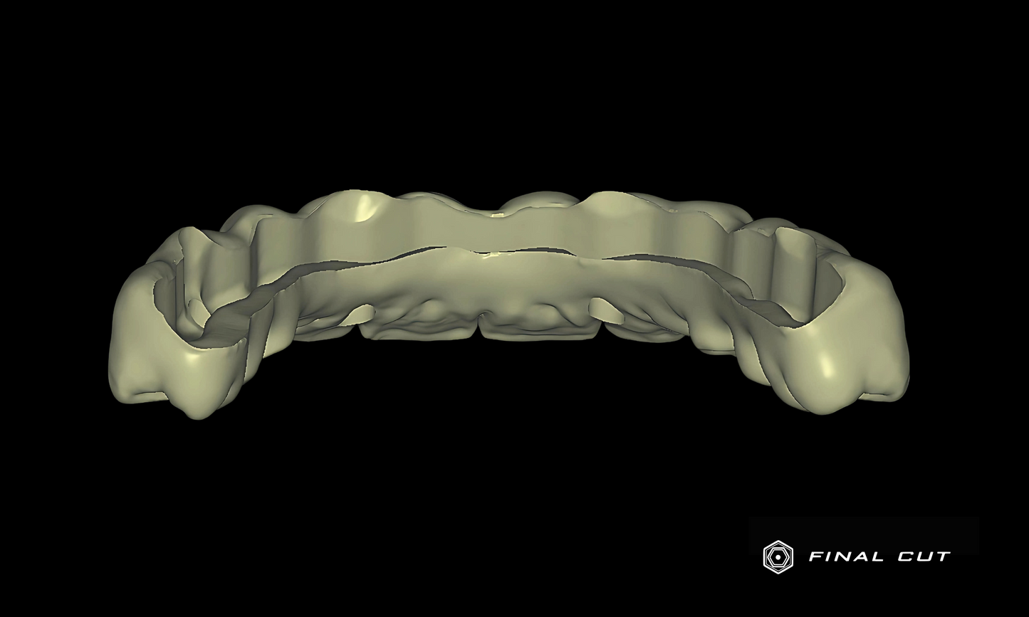 Zirconia Full Arch Over Bar - Design Service - FinalCut™
