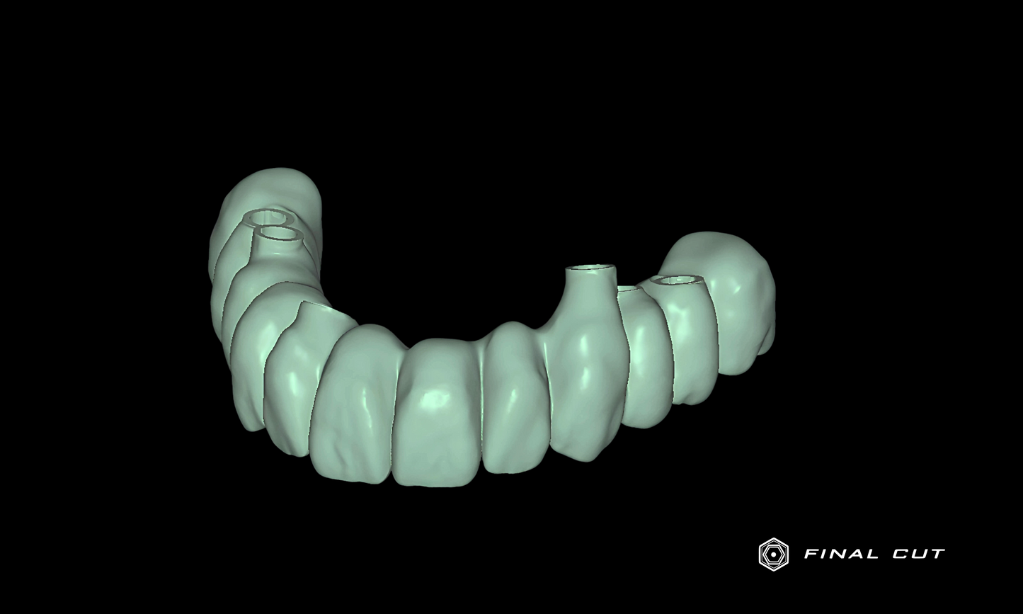 Zirconia Hybrid Full Arch - Design Service - FinalCut™