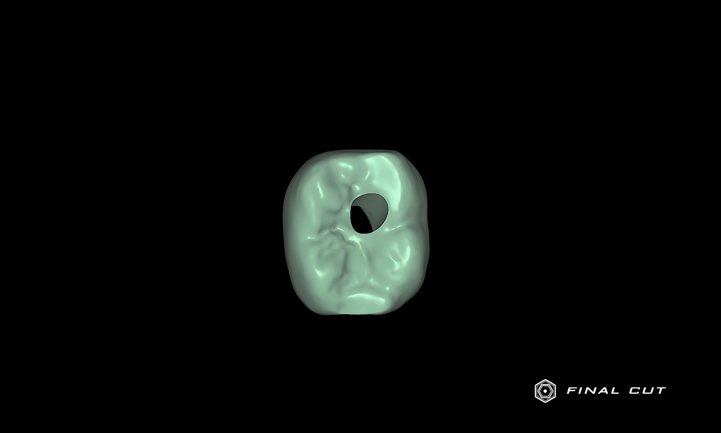 Zirconia Implant Crown & Bridge - Design Service - FinalCut™