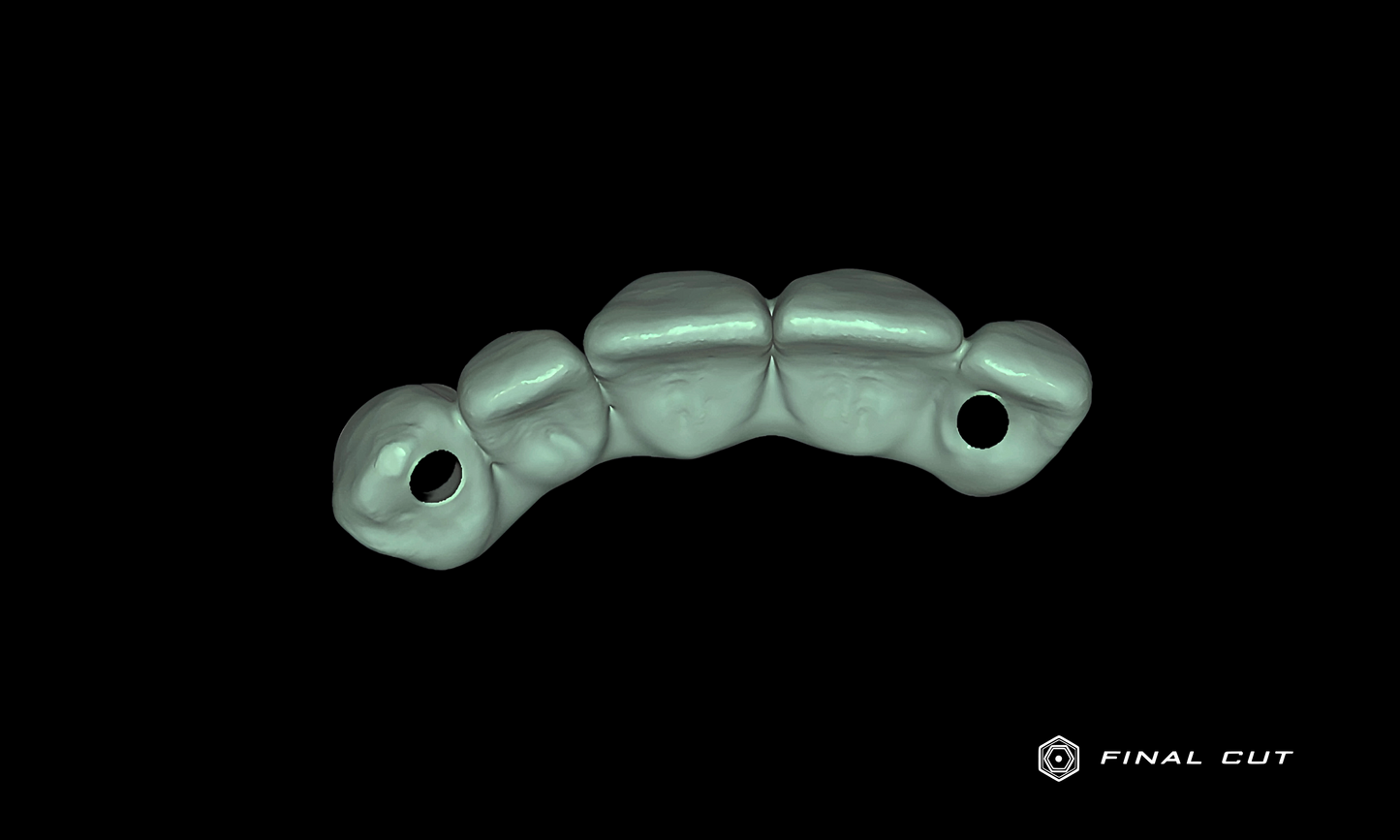 Zirconia Implant Crown & Bridge - Design Service - FinalCut™