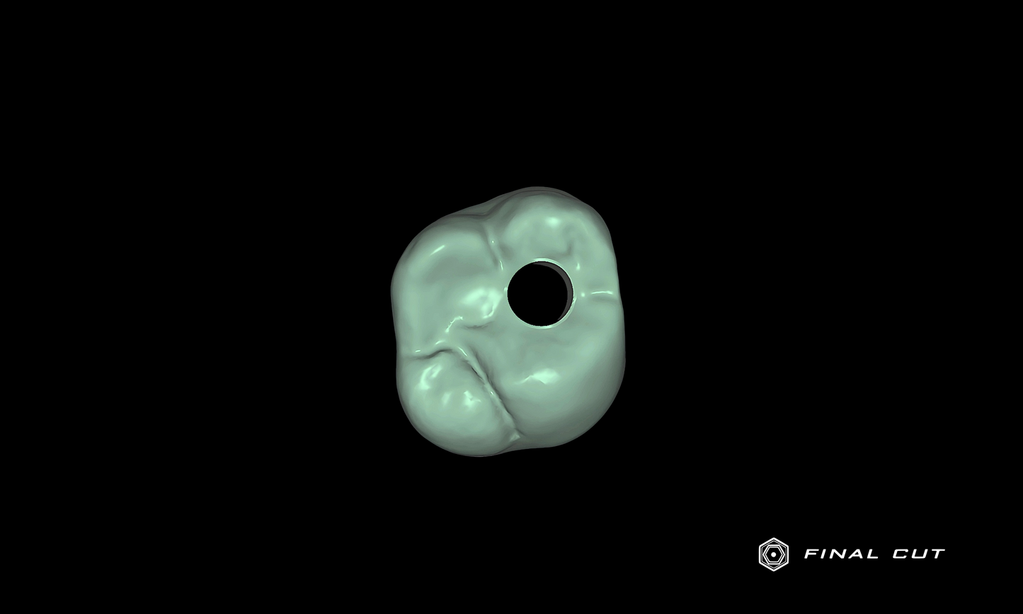 Zirconia Implant Crown & Bridge - Design Service - FinalCut™