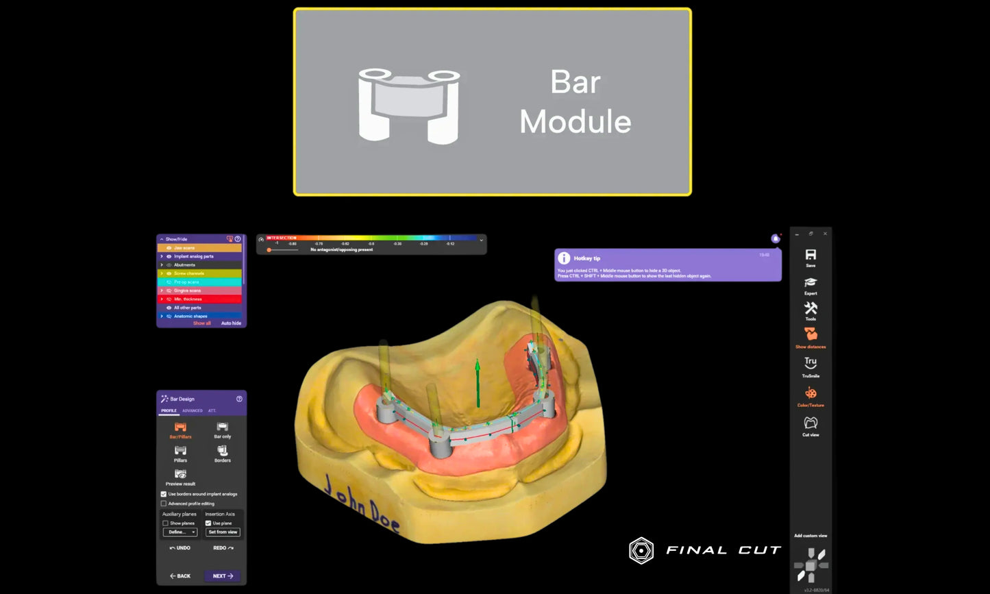 Exocad Software - Implant Package - FinalCut™