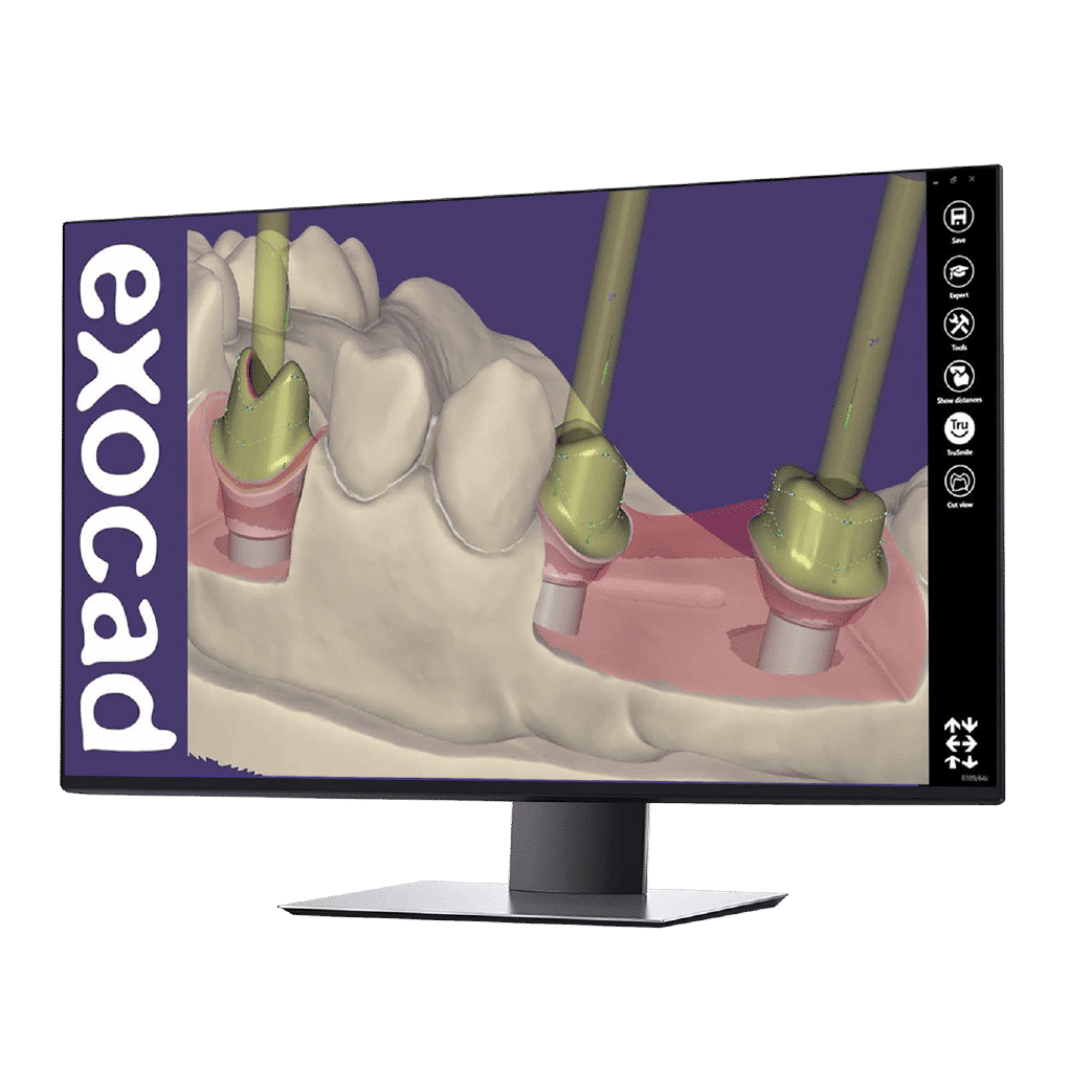 Exocad Software - Implant Package - FinalCut™