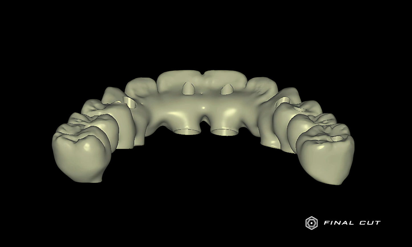 PMMA Hybrid Full Arch - Design Service - FinalCut™