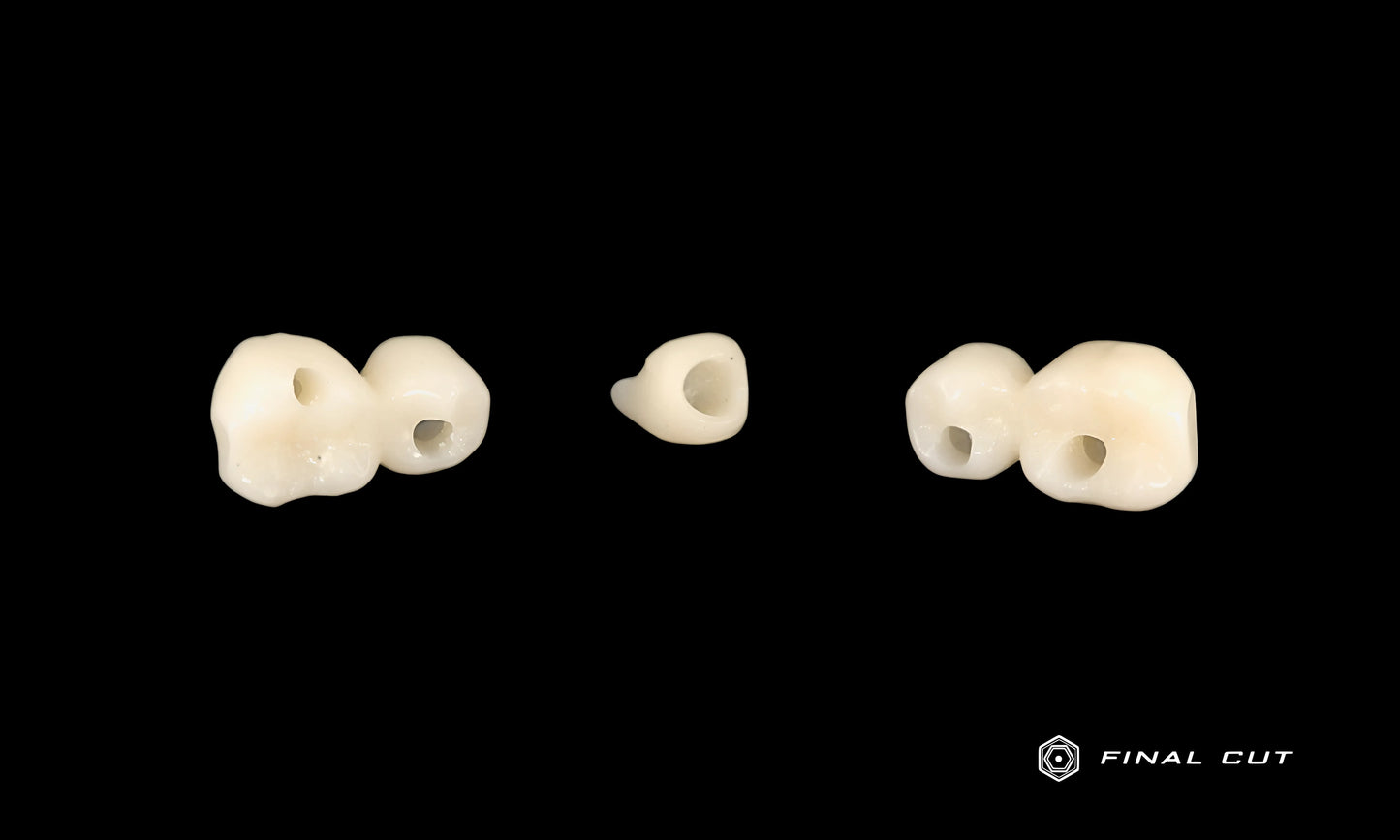 PMMA Implant Crown & Bridge - Milling Service - FinalCut™