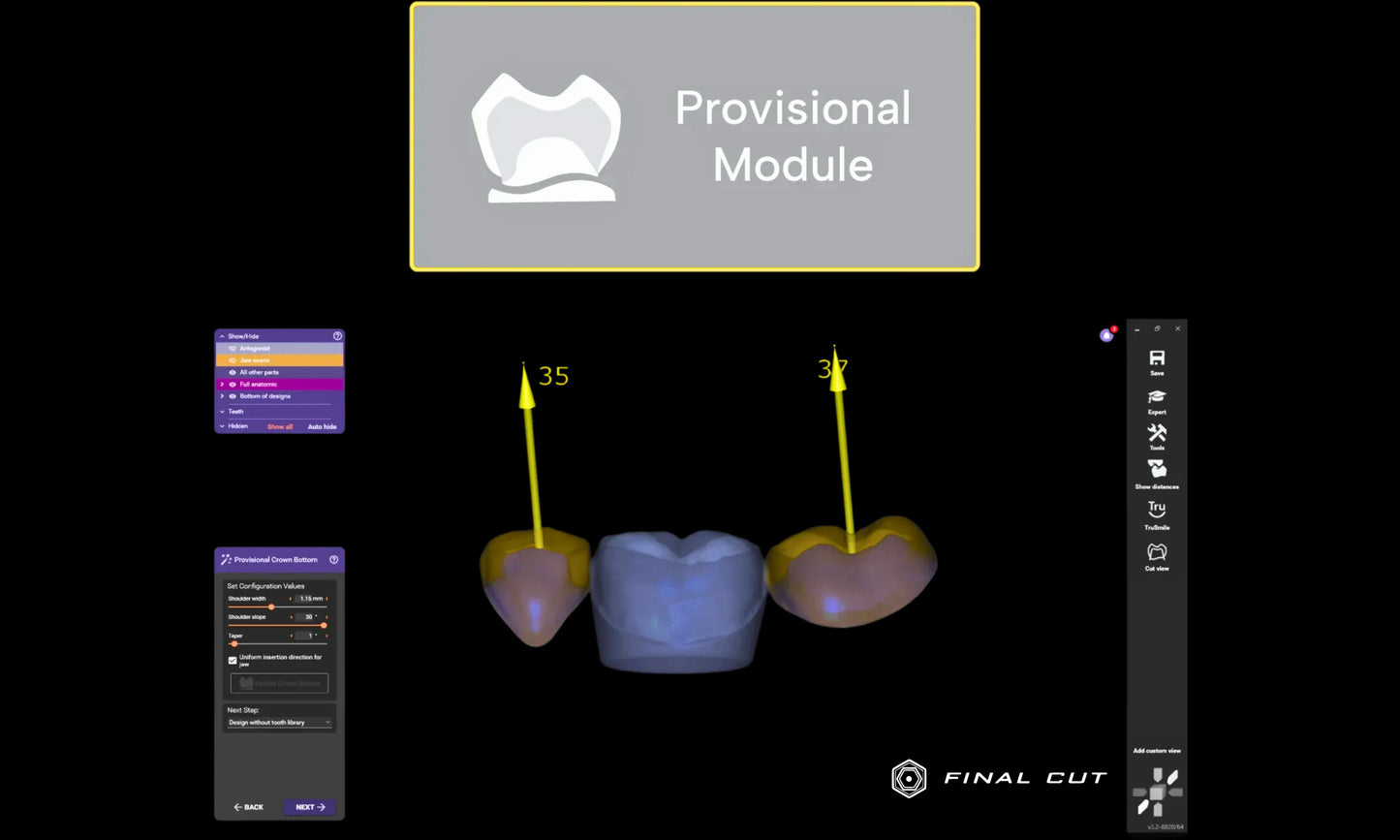 Exocad Software - Implant Package - FinalCut™