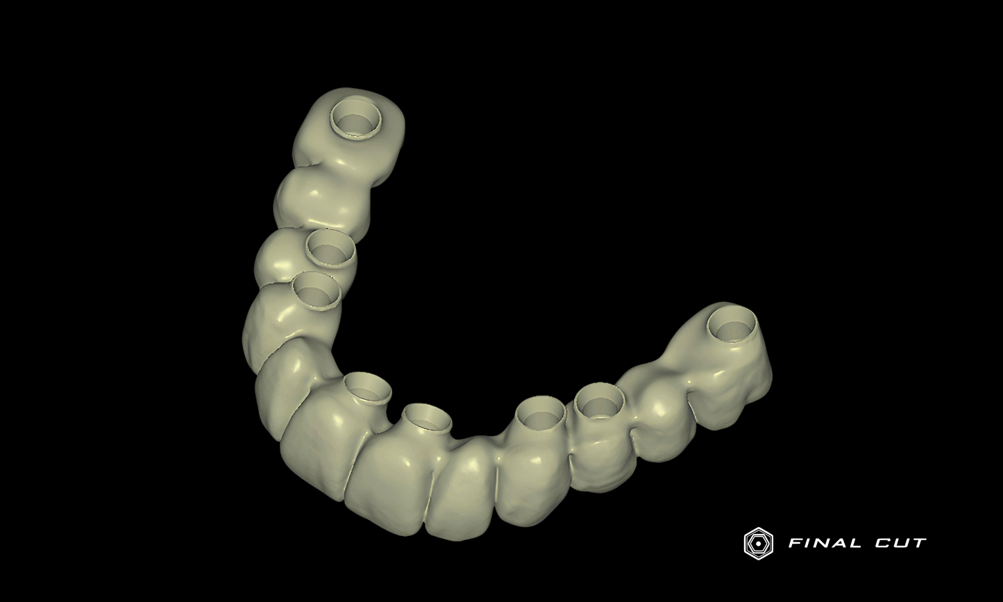 Zirconia Hybrid Full Arch - Design & Milling Service - FinalCut™