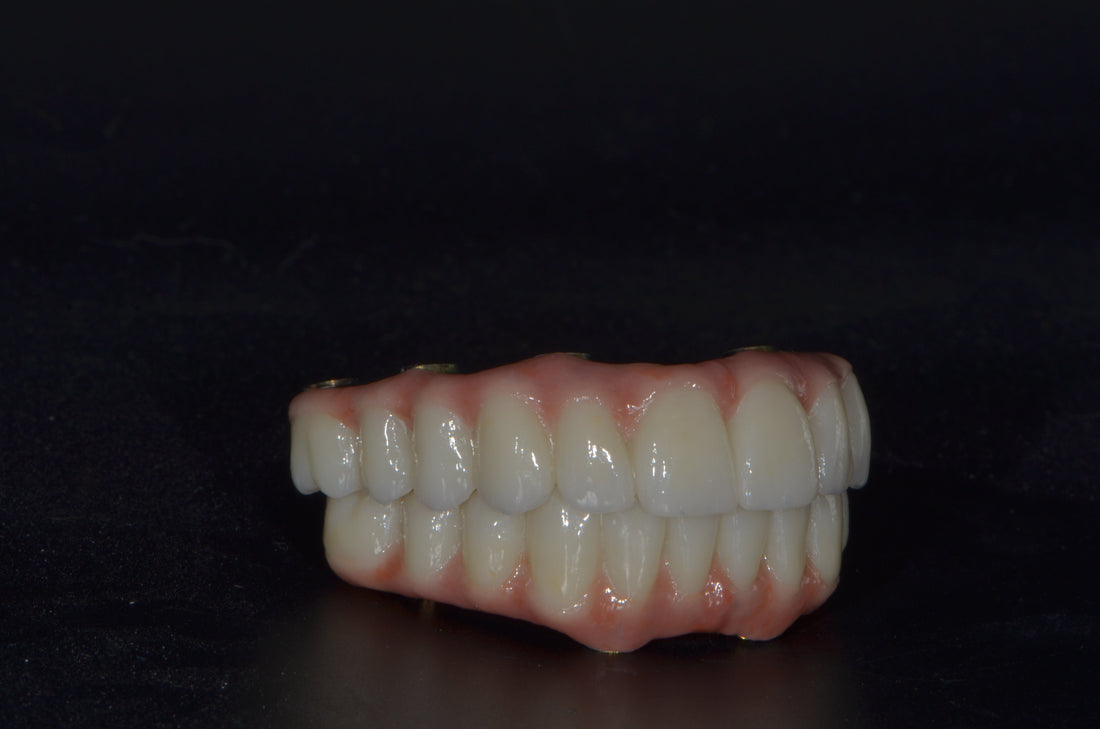 full arch dental