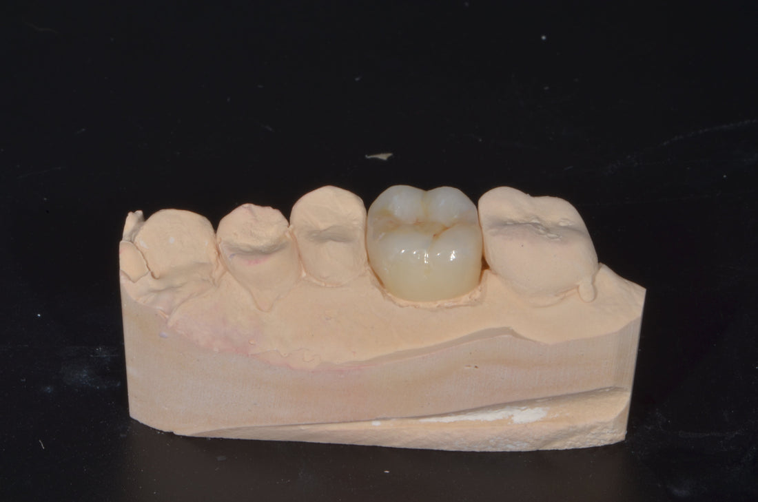 What defines quality materials in Florida dental milling?