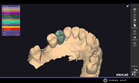 Zirconia Implant Crown & Bridge - Design & Milling Service - FinalCut™