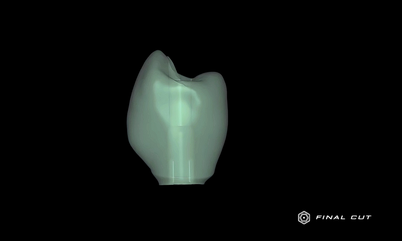 Zirconia Implant Crown & Bridge - Design & Milling Service - FinalCut™