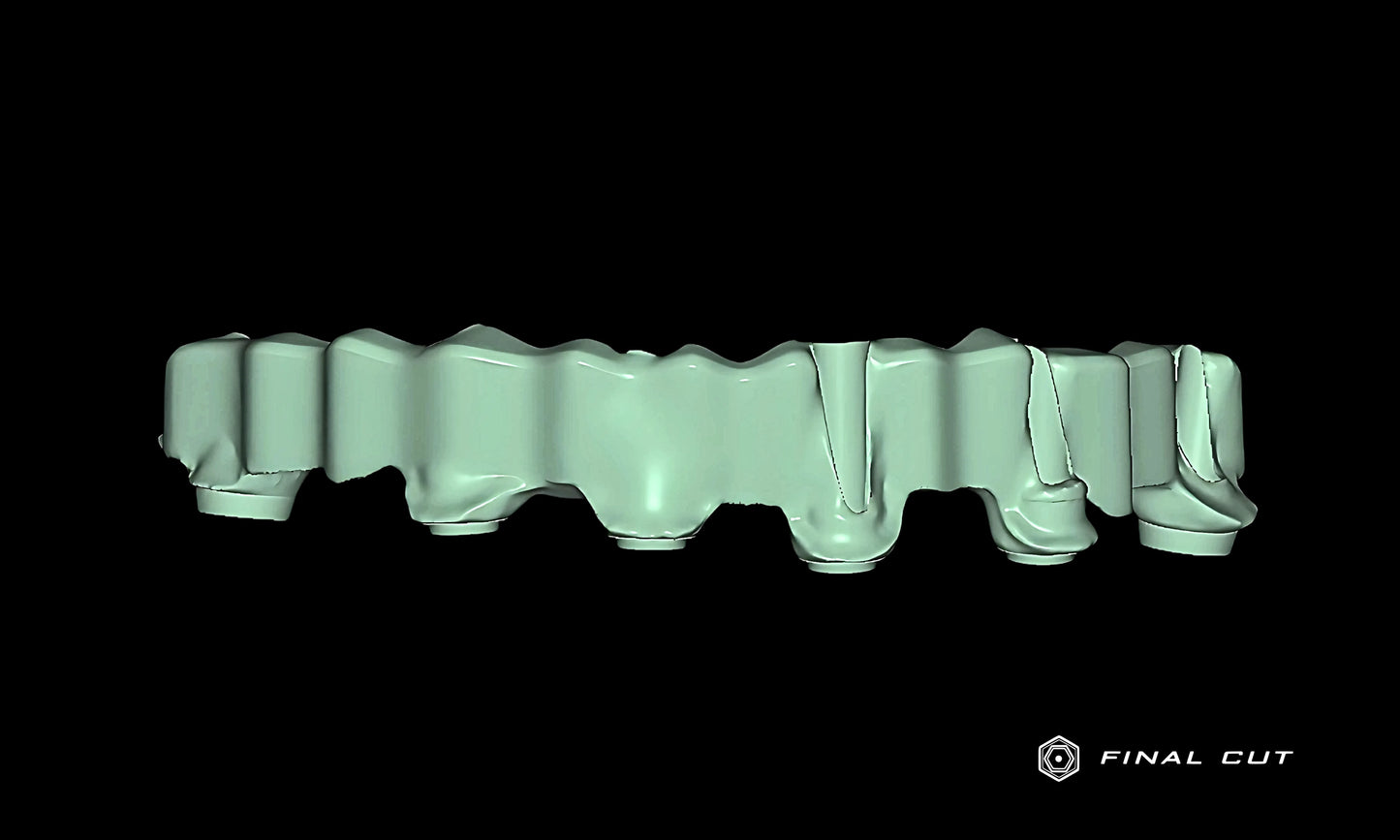 Titanium Custom Abutment - Design Service - FinalCut™