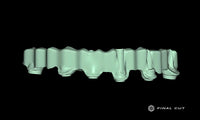Titanium Custom Abutment - Design Service - FinalCut™