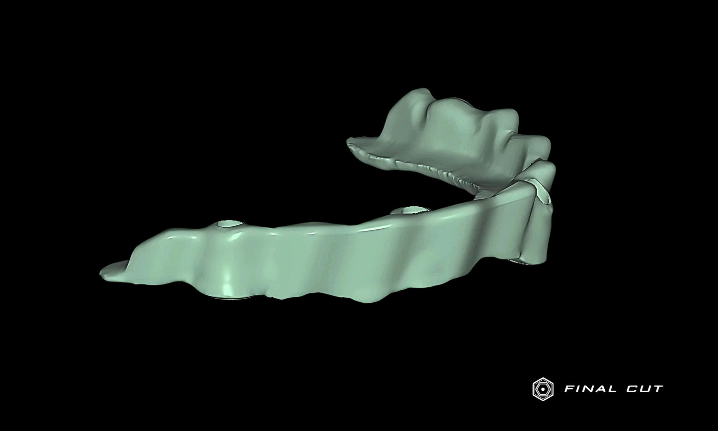 Titanium Custom Abutment - Design Service - FinalCut™