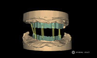 Titanium Custom Abutment - Design & Milling Service - FinalCut™