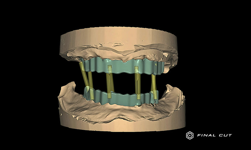 Titanium Custom Abutment - Design & Milling Service - FinalCut™