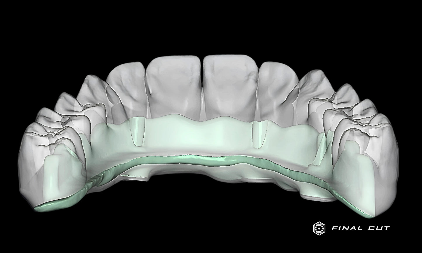 Titanium Custom Abutment - Design & Milling Service - FinalCut™
