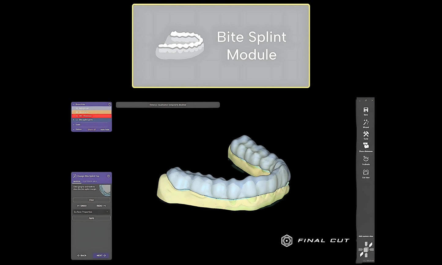 Bite Splint Module - FinalCut™
