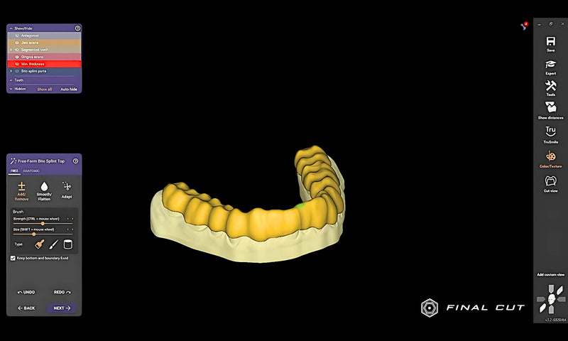 Bite Splint Module - FinalCut™