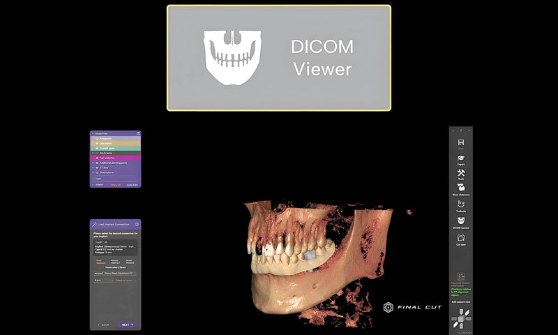 DICOM Viewer - FinalCut™