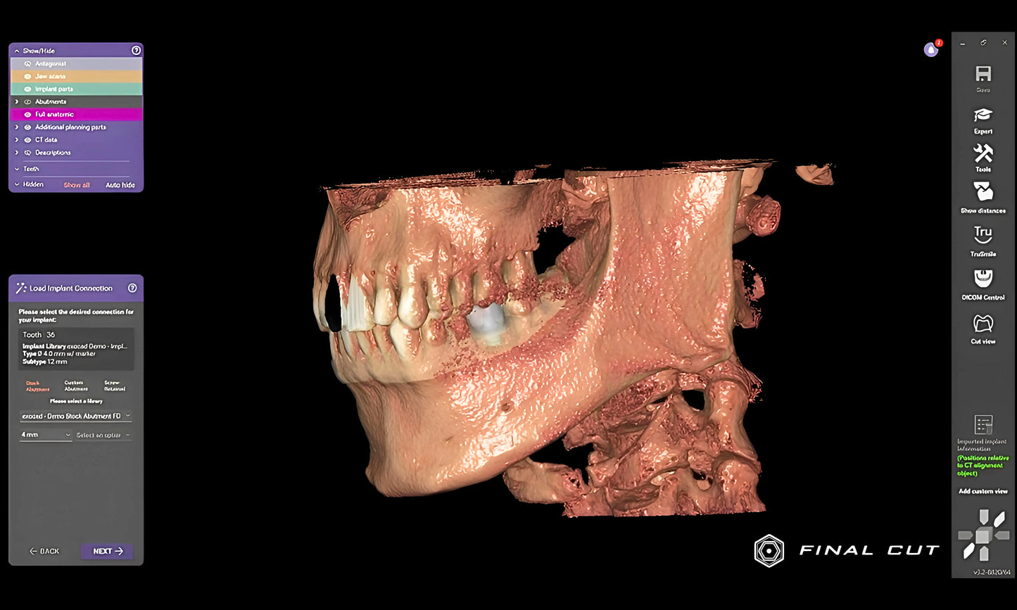 DICOM Viewer - FinalCut™