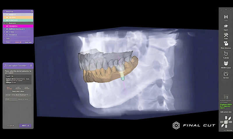 DICOM Viewer - FinalCut™
