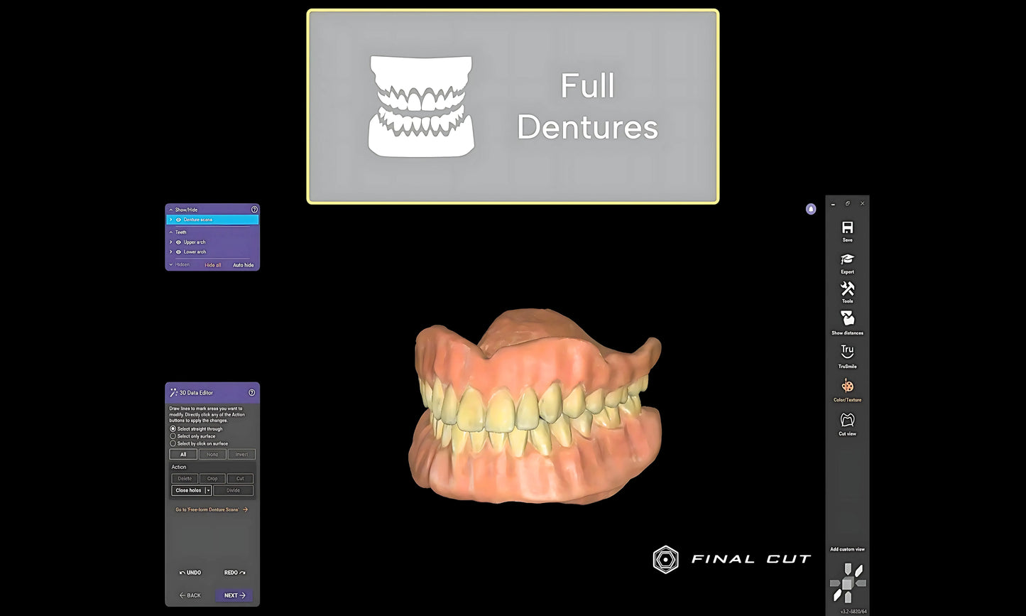 FullDenture Module - FinalCut™