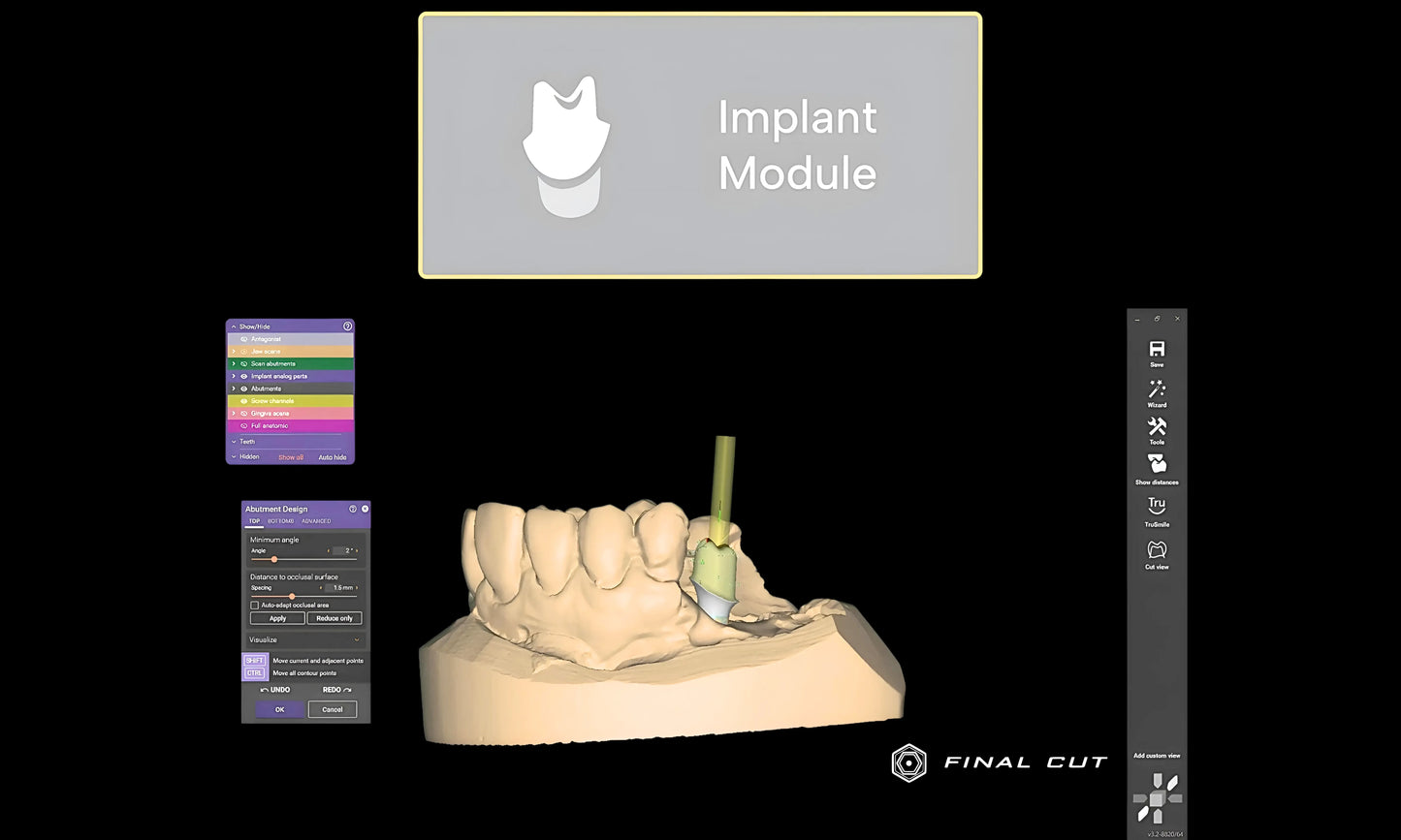 Implant Module - FinalCut™