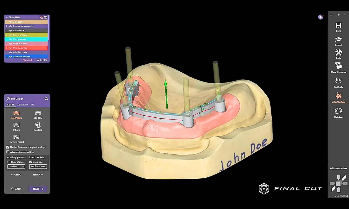 Implant Module - FinalCut™