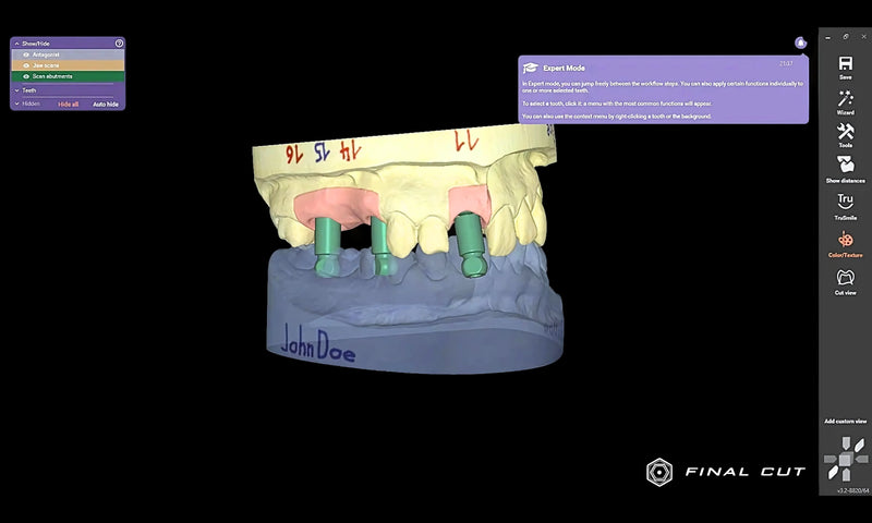 Implant Module - FinalCut™