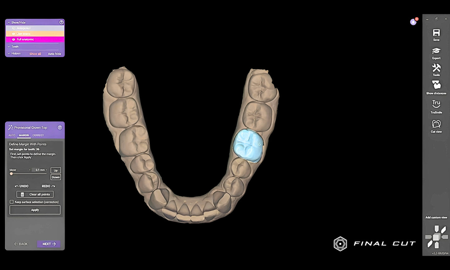Provisional Module - FinalCut™