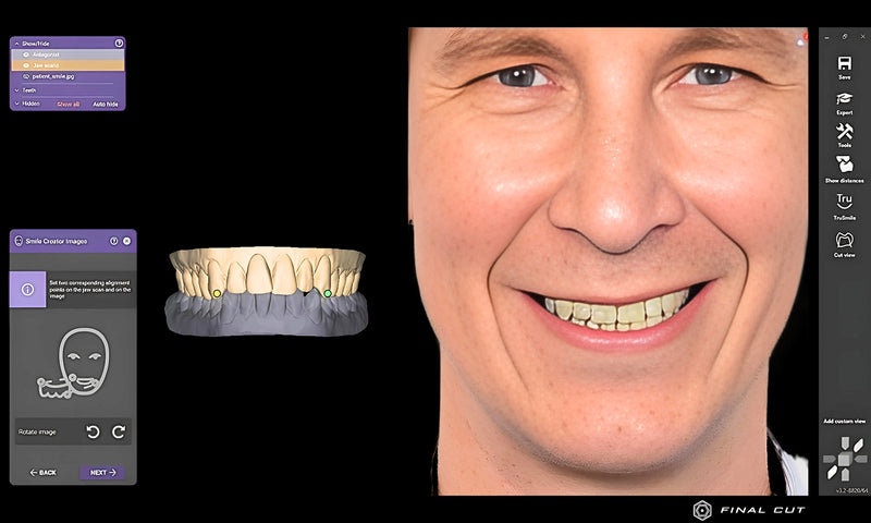 Smile Creator - FinalCut™