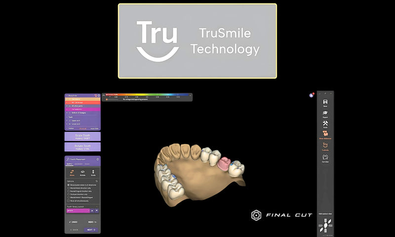 TruSmile Module - FinalCut™
